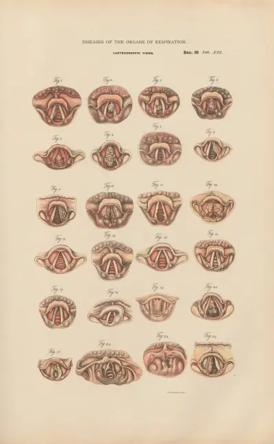 Laryngoscopic Views av Jean Allard Jeancon