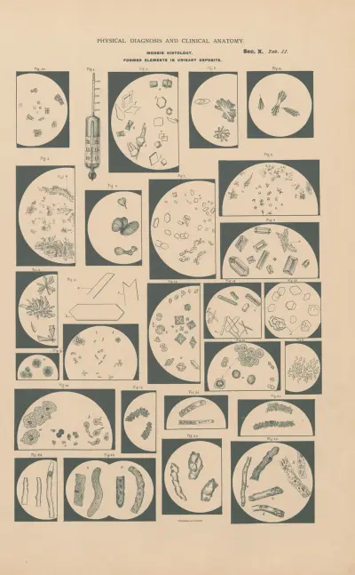 Morphological elements in urinary deposits av Jean Allard Jeancon