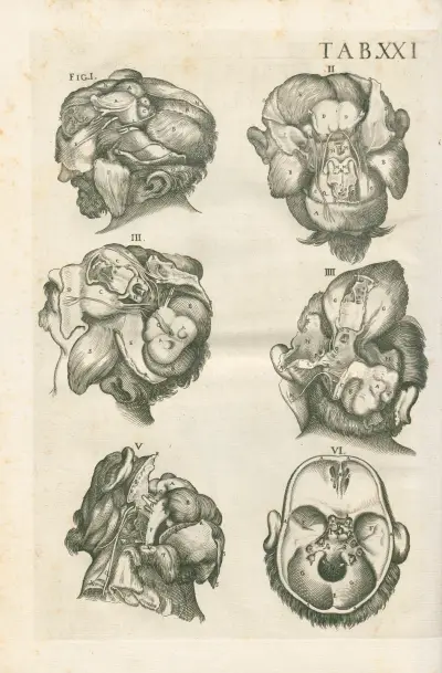 Tabulae anatomicae a celeberrimo pictore Petro Berretino Cortonensi Pl.21 av Pietro da Cortona
