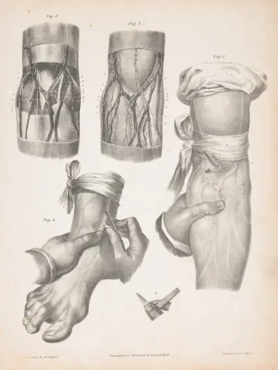 Blodkärl i en arm och en fot, med två genomskärningar av en arm eller ett ben som visar anatomin under huden av James Fuller Queen