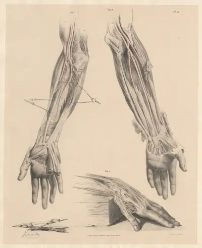 Underliga former av radial-, ulnar- och interosseusartärerna i underarm och hand av Joseph Maclise