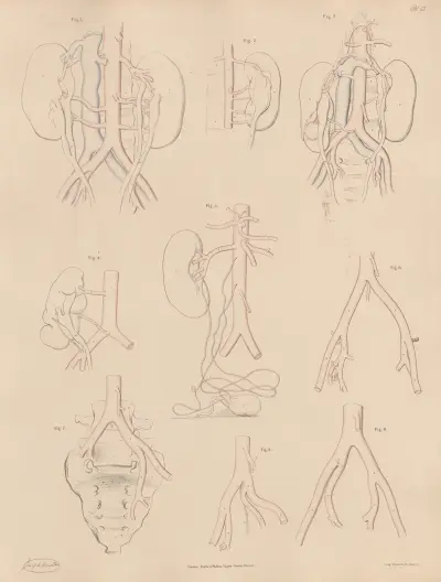 Peculiarities of some of the branches of the Abdominal Aorta, and of the Iliac arteries av Joseph Maclise
