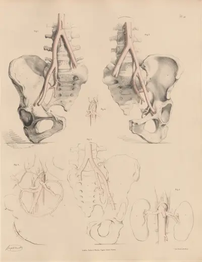 Peculiarities of the Abdominal Aorta, and of some of its branches av Joseph Maclise