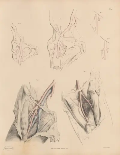 Peculiarities of the branches of the Deep Femoral, especially of the External Circumflex av Joseph Maclise