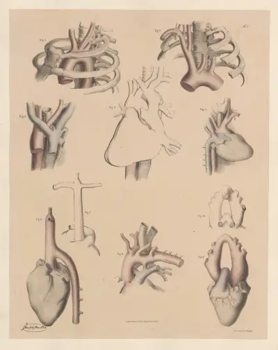 Peculiarities of the commencement of the Aorta—affecting its position, direction, and shape av Joseph Maclise