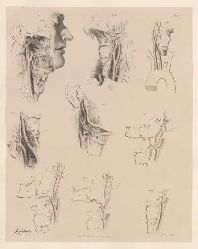 Besonderheiten der Arteria carotis communis und der Arteria carotis externa von Joseph Maclise
