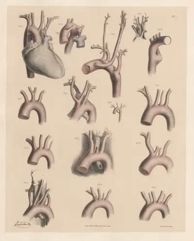 Egenheter hos de stora grenarna med ursprung från aortabågen av Joseph Maclise