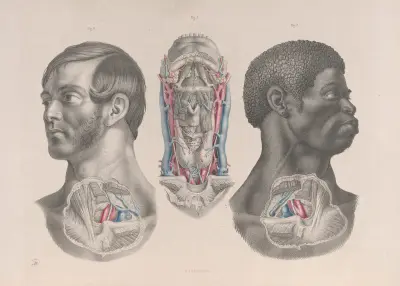Surgical anatomy Pl.04 av Joseph Maclise