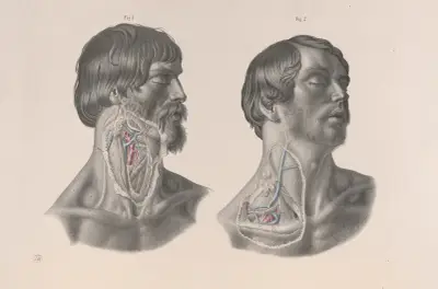 Surgical anatomy Pl.07 av Joseph Maclise