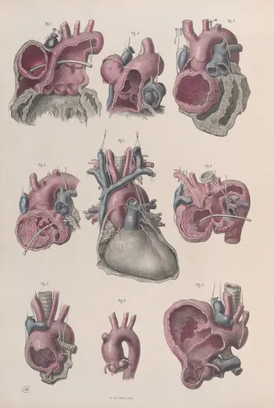 Surgical anatomy Pl.14 av Joseph Maclise