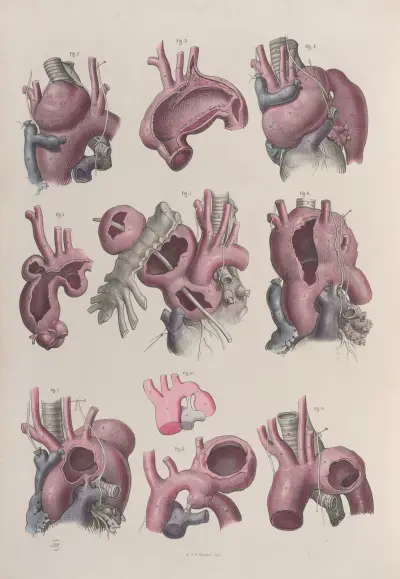 Surgical anatomy Pl.15 av Joseph Maclise