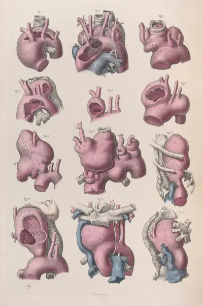 Surgical anatomy Pl.16 av Joseph Maclise