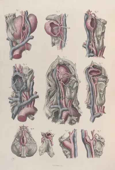 Surgical anatomy Pl.17 av Joseph Maclise