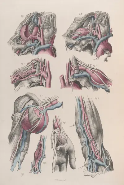 Surgical anatomy Pl.18 av Joseph Maclise