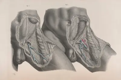 Surgical anatomy Pl.27 av Joseph Maclise