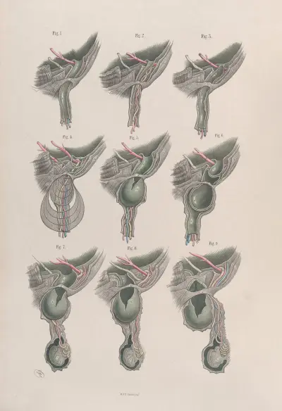 Surgical anatomy Pl.33 av Joseph Maclise