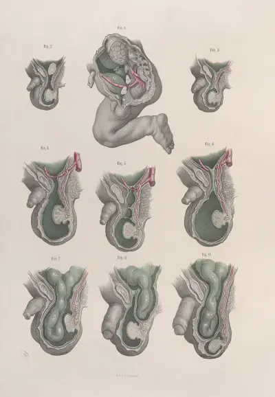 Surgical anatomy Pl.34 av Joseph Maclise