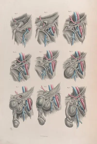 Surgical anatomy Pl.38 av Joseph Maclise