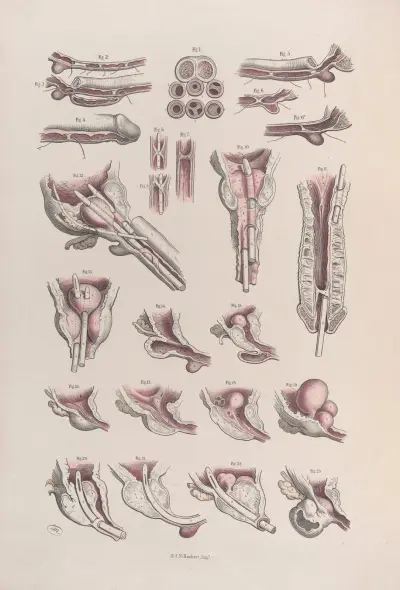 Surgical anatomy Pl.45 av Joseph Maclise