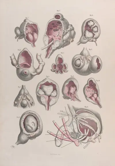 Surgical anatomy Pl.47 av Joseph Maclise