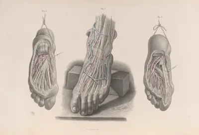 Surgical anatomy Pl.51 av Joseph Maclise