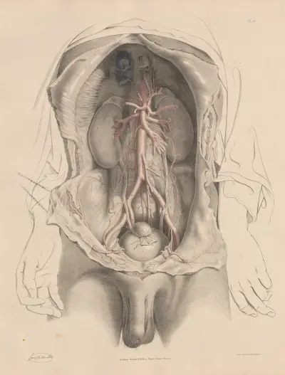 The Abdominal Aorta and the branches arising in its course. The Iliac arteries av Joseph Maclise