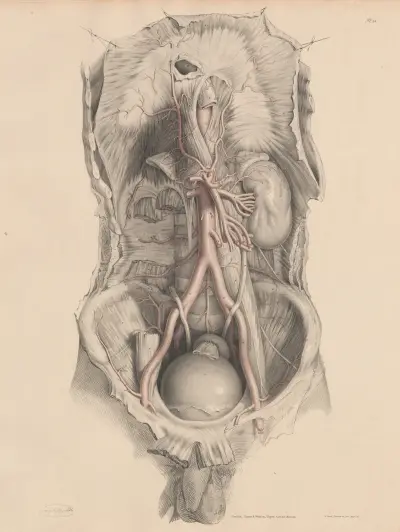 The Abdominal Aorta av Joseph Maclise
