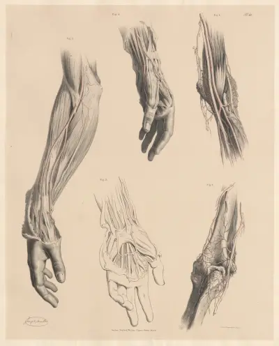 De artäriella grenarna som anastomoserar kring armbågsleden, egenheter hos radialartären av Joseph Maclise