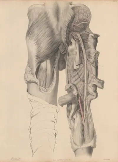 The Arteries on the Pelvis more completely exposed av Joseph Maclise