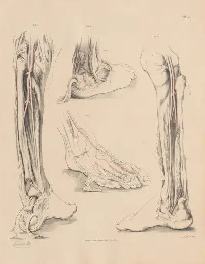 Fotens dorsala artär av Joseph Maclise