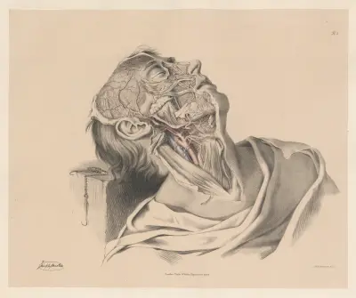 Den yttre halspulsådern och dess grenar av Joseph Maclise