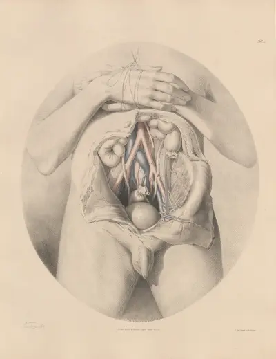 The Iliac arteries in connexion with the veins av Joseph Maclise