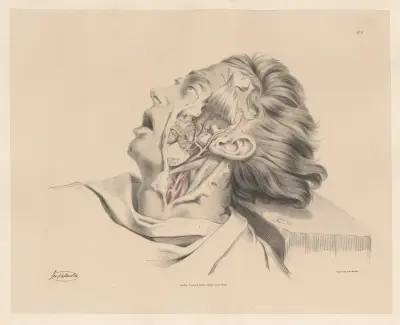 Inre maxillarisartären av Joseph Maclise
