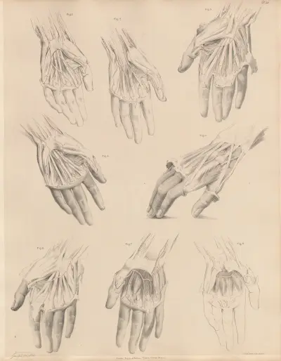 Various conditions of the arteries of the hand av Joseph Maclise