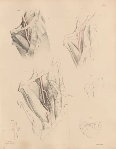 Various forms of the Deep Femoral artery av Joseph Maclise
