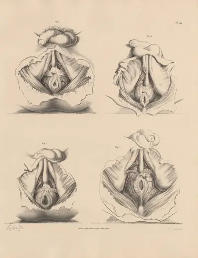 Various forms of the Pudic branches seen in the Perineum av Joseph Maclise