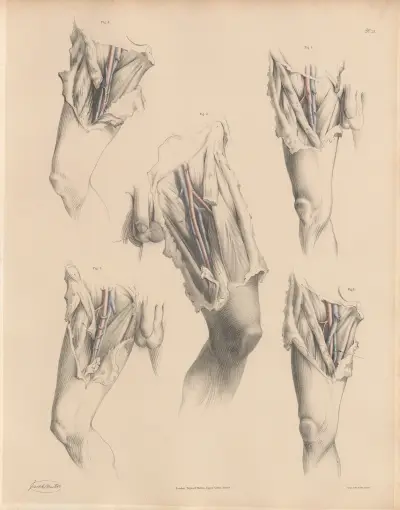 Various forms of the Veins connected with the Femoral artery av Joseph Maclise