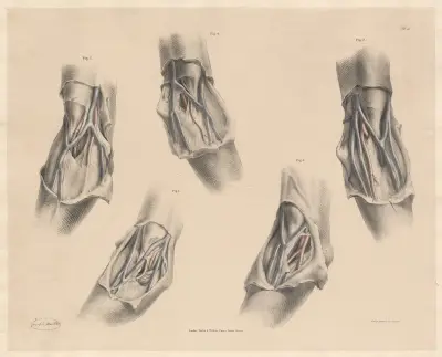 Vy av de ytliga venerna framför armbågsleden, i samband med flera variationer av artärerna av Joseph Maclise