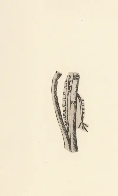 Blutgefäße von Lucas Kilian