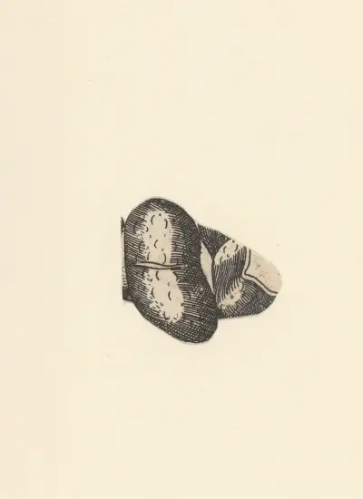 Kidney. – nr 2 av Lucas Kilian