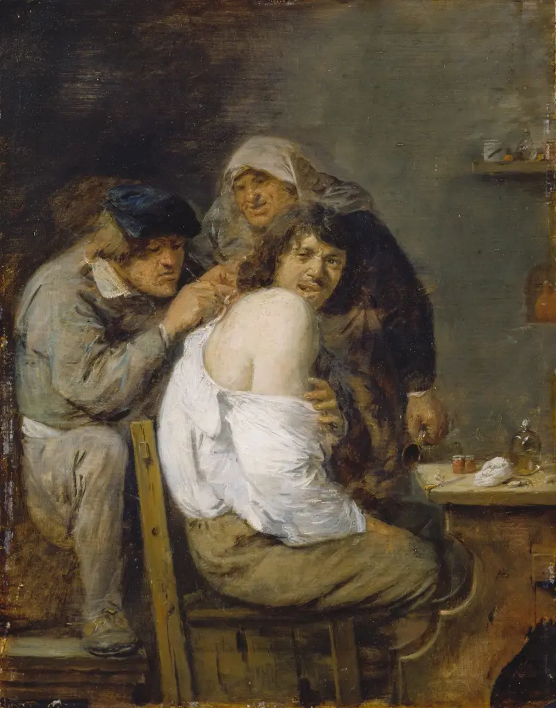 Operace zad, Adriaen Brouwer