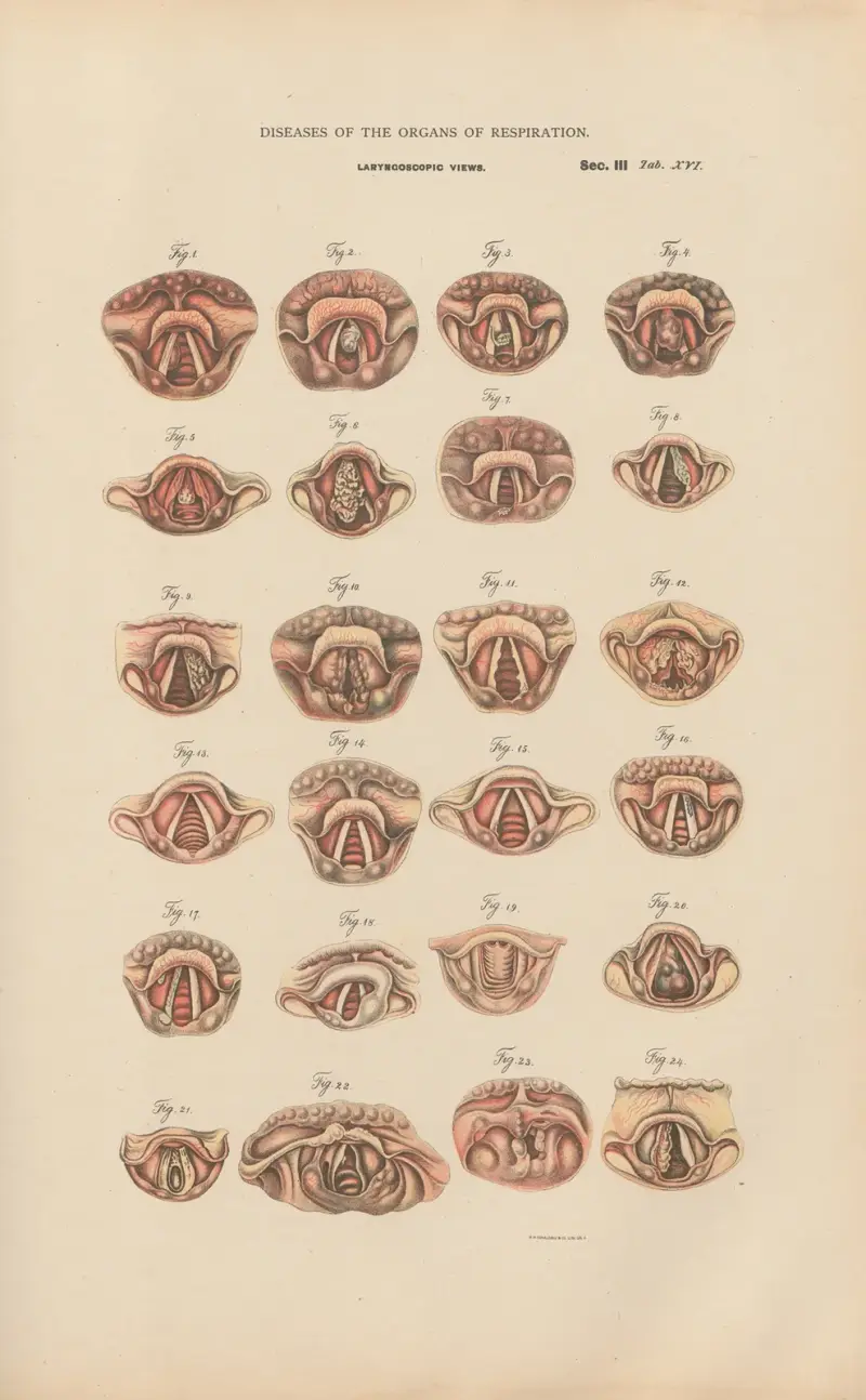 Laryngoscopic Views av Jean Allard Jeancon