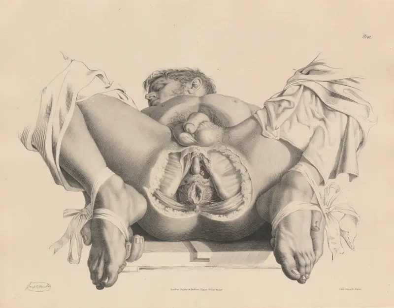 A deeper dissection of the Perineum. The Pudic artery and the artery of the Bulb are shown av Joseph Maclise