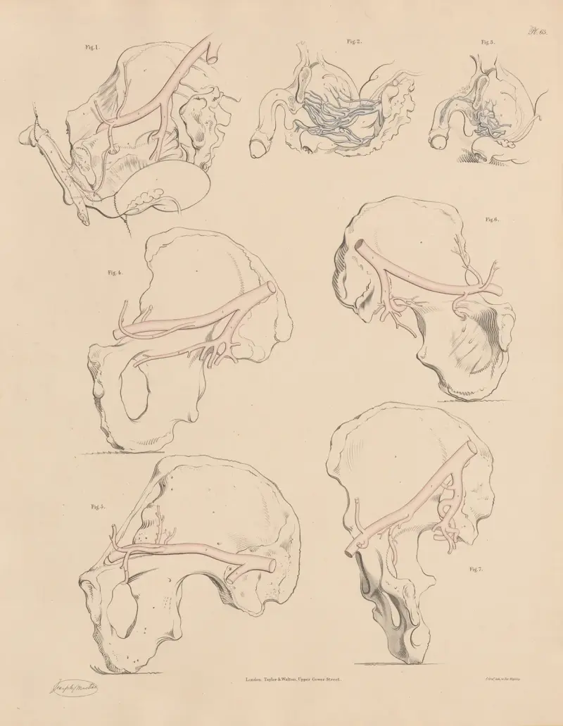 A peculiarity of one of the Pudic branches, Enlarged veins of the Prostate Gland and Urinary Bladder av Joseph Maclise