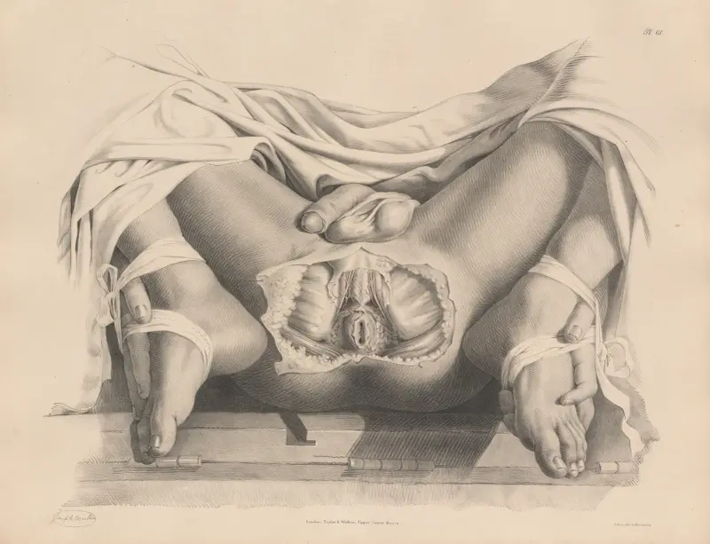 A view of the Arteries and other structures displayed in a superficial dissection of the Perineum av Joseph Maclise