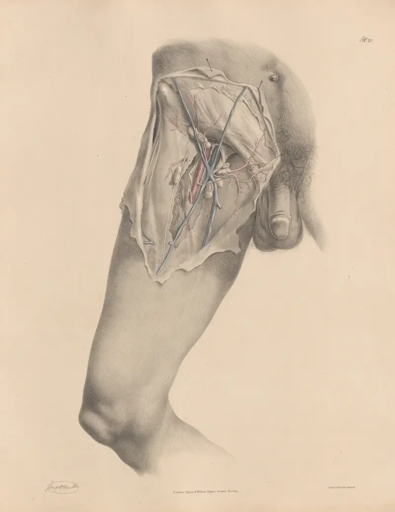 A view of the Femoral artery, with the veins, nerves, and fascia av Joseph Maclise