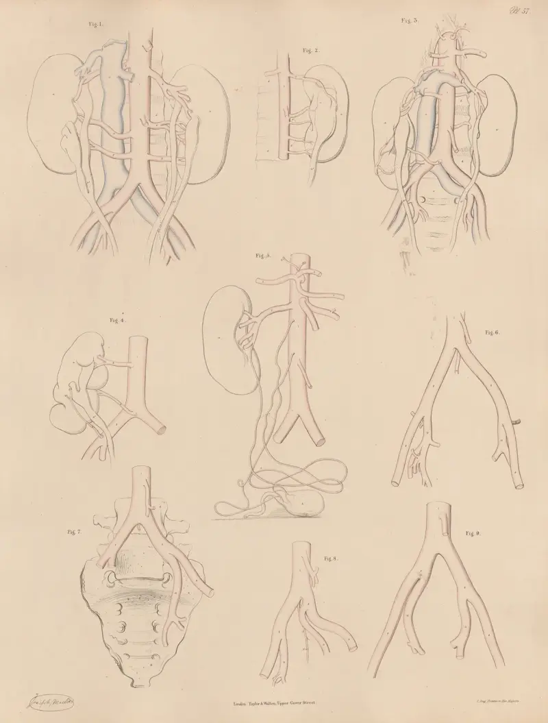 Peculiarities of some of the branches of the Abdominal Aorta, and of the Iliac arteries av Joseph Maclise