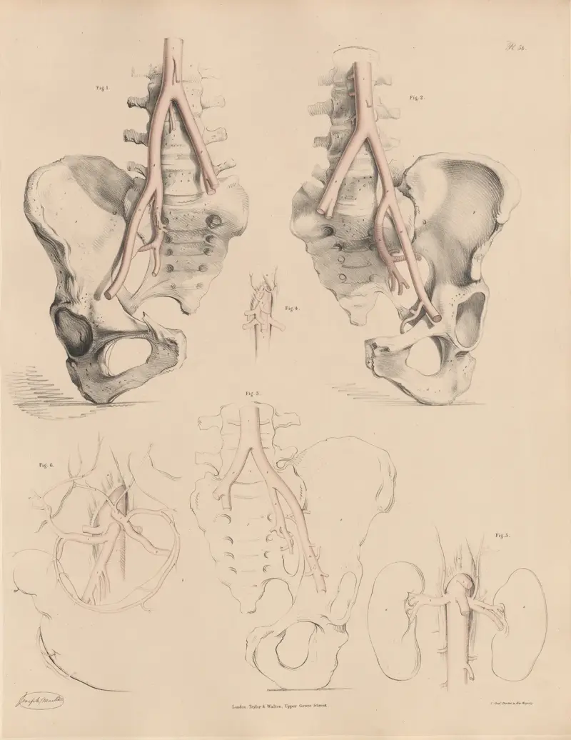 Peculiarities of the Abdominal Aorta, and of some of its branches av Joseph Maclise