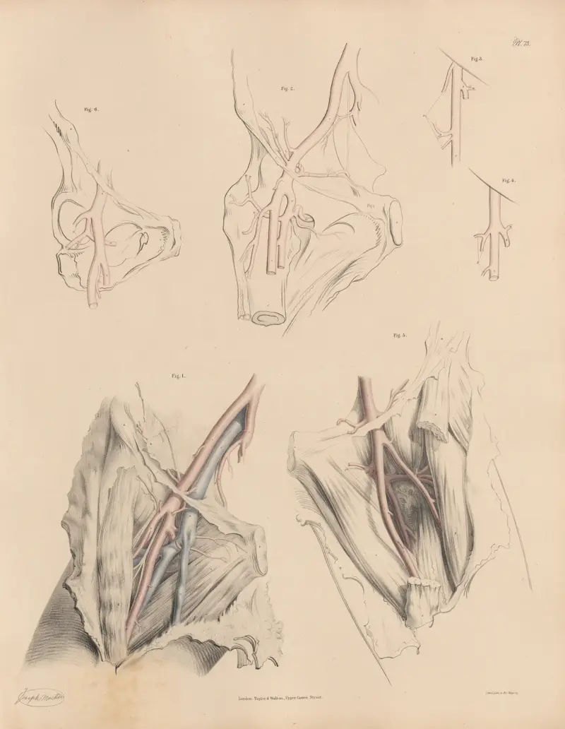 Peculiarities of the branches of the Deep Femoral, especially of the External Circumflex av Joseph Maclise