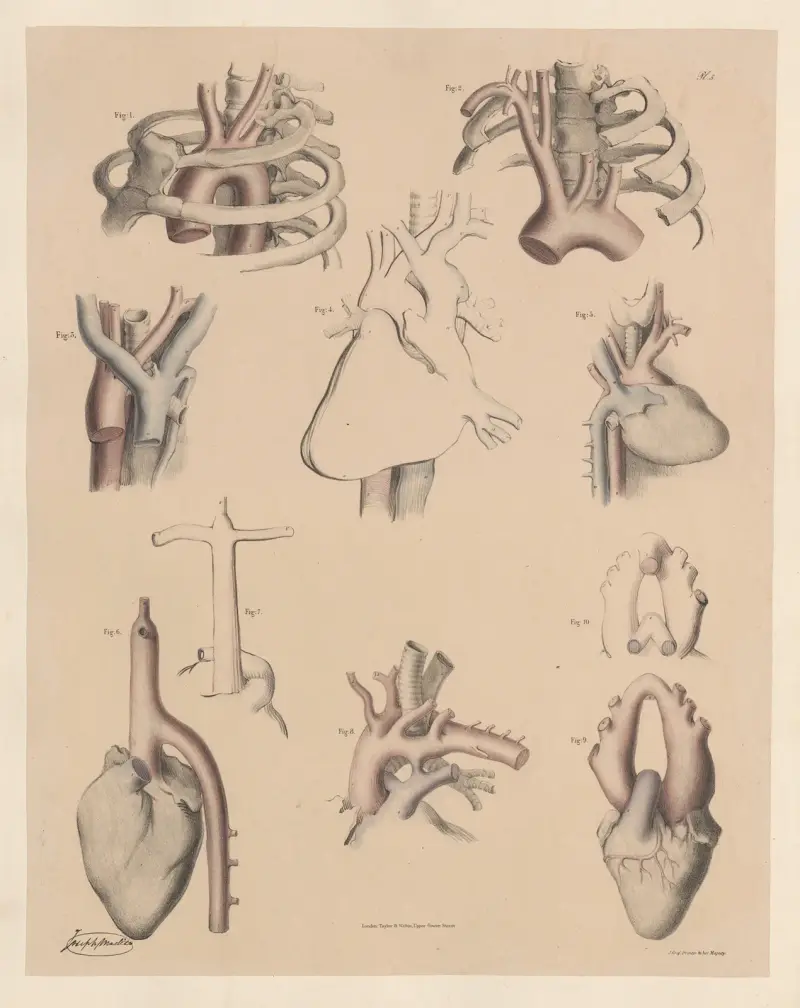 Peculiarities of the commencement of the Aorta—affecting its position, direction, and shape av Joseph Maclise